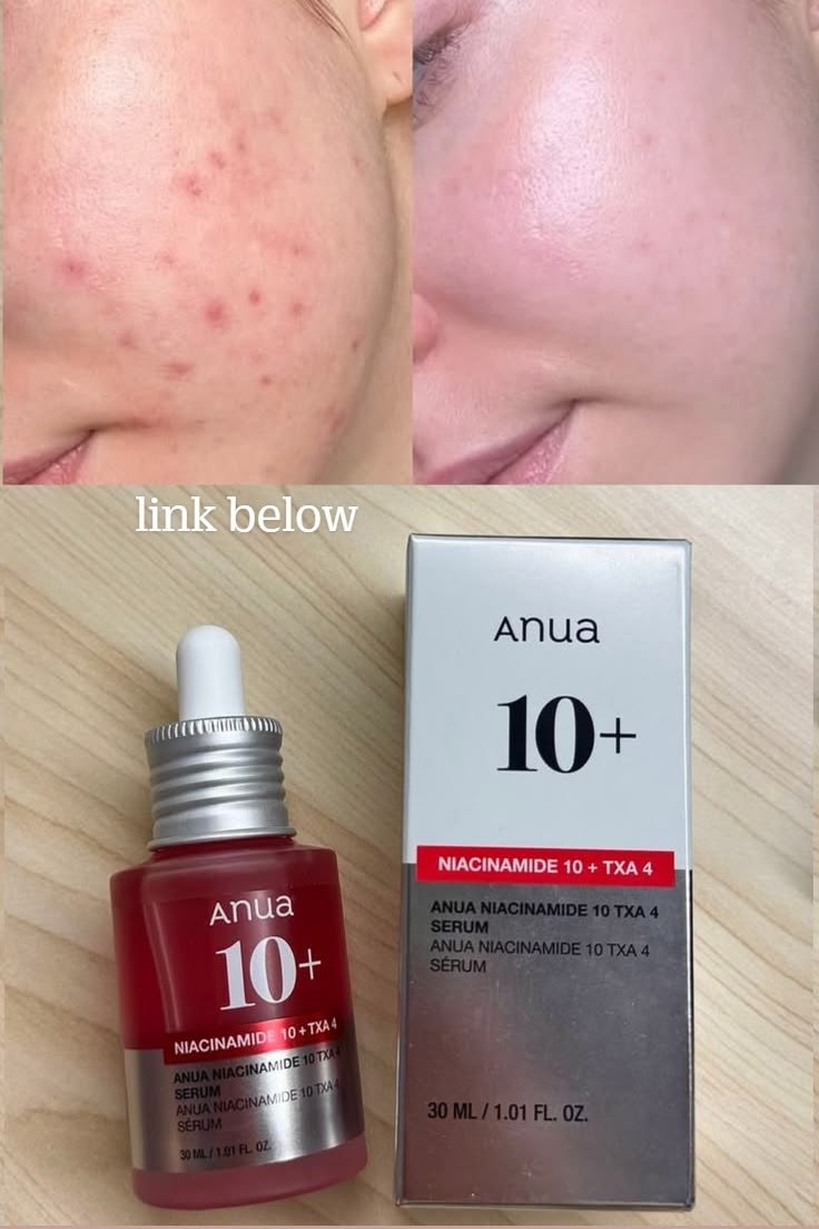 Suero Anua Niacinamida 10% + Ácido Tranexámico 4% - Despigmentante e Iluminador